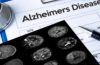 Lifestyle modifies improved cognition in individuals in danger for Alzheimer’s, the study reveals