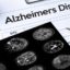 Lifestyle modifies improved cognition in individuals in danger for Alzheimer’s, the study reveals