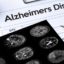 Lifestyle modifies improved cognition in individuals in danger for Alzheimer’s, the study reveals
